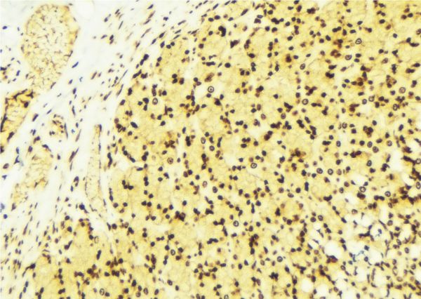 PRMT1 Antibody - 1:100 staining human gastric tissue by IHC-P. The sample was formaldehyde fixed and a heat mediated antigen retrieval step in citrate buffer was performed. The sample was then blocked and incubated with the antibody for 1.5 hours at 22°C. An HRP conjugated goat anti-rabbit antibody was used as the secondary.