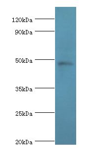 PRMT2 Antibody - Western blot. All lanes: PRMT2 antibody at 4 ug/ml+HL-60 whole cell lysate. Secondary antibody: Goat polyclonal to rabbit at 1:10000 dilution. Predicted band size: 49 kDa. Observed band size: 49 kDa.