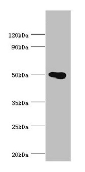 PRMT2 Antibody - Western blot All lanes: PRMT2 antibody at 4µg/ml + HL60 whole cell lysate Secondary Goat polyclonal to rabbit IgG at 1/10000 dilution Predicted band size: 50, 32, 38, 33, 34, 26, 32 kDa Observed band size: 50 kDa