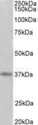 PRMT2 Antibody - PRMT2 antibody (2 ug/ml) staining of HeLa lysate (35 ug protein in RIPA buffer). Primary incubation was 1 hour. Detected by chemiluminescence.
