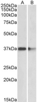 PRMT2 Antibody - Goat Anti-PRMT2 Antibody (2µg/ml) staining of Mouse (A) and Rat (B) Brain lysates (35µg protein in RIPA buffer). Primary incubation was 1 hour. Detected by chemiluminescencence.