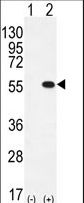 PRMT2 Antibody - Western blot of PRMT2 (arrow) using rabbit polyclonal PRMT2 Antibody (L359). 293 cell lysates (2 ug/lane) either nontransfected (Lane 1) or transiently transfected (Lane 2) with the PRMT2 gene.