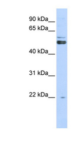PRMT2 Antibody - PRMT2 antibody Western blot of 293T cell lysate. This image was taken for the unconjugated form of this product. Other forms have not been tested.