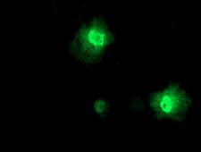 PRMT2 Antibody - Anti-PRMT2 mouse monoclonal antibody immunofluorescent staining of COS7 cells transiently transfected by pCMV6-ENTRY PRMT2.