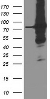 PRMT2 Antibody - HEK293T cells were transfected with the pCMV6-ENTRY control (Left lane) or pCMV6-ENTRY PRMT2 (Right lane) cDNA for 48 hrs and lysed. Equivalent amounts of cell lysates (5 ug per lane) were separated by SDS-PAGE and immunoblotted with anti-PRMT2.