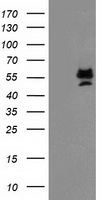PRMT2 Antibody - HEK293T cells were transfected with the pCMV6-ENTRY control (Left lane) or pCMV6-ENTRY PRMT2 (Right lane) cDNA for 48 hrs and lysed. Equivalent amounts of cell lysates (5 ug per lane) were separated by SDS-PAGE and immunoblotted with anti-PRMT2.