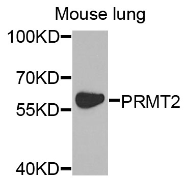 PRMT2 Antibody - Western blot analysis of extracts of mouse lung cells.
