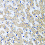 PRMT2 Antibody - Immunohistochemistry of paraffin-embedded human liver injury tissue.