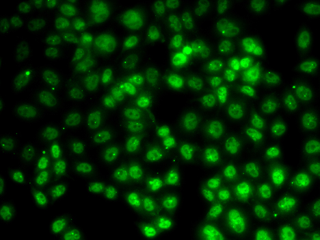 PRMT2 Antibody - Immunofluorescence analysis of HeLa cells.