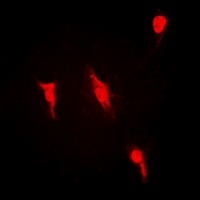 PRMT2 Antibody - Immunofluorescent analysis of PRMT2 staining in HeLa cells. Formalin-fixed cells were permeabilized with 0.1% Triton X-100 in TBS for 5-10 minutes and blocked with 3% BSA-PBS for 30 minutes at room temperature. Cells were probed with the primary antibody in 3% BSA-PBS and incubated overnight at 4 deg C in a humidified chamber. Cells were washed with PBST and incubated with a DyLight 594-conjugated secondary antibody (red) in PBS at room temperature in the dark.