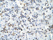 PRMT2 Antibody - PRMT2 antibody ARP40196_T100-NP_001526-PRMT2 (protein arginine methyltransferase 2) Antibody was used in IHC to stain formalin-fixed, paraffin-embedded human liver.  This image was taken for the unconjugated form of this product. Other forms have not been tested.