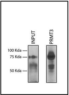 PRMT3 Antibody - PRMT3 Antibody in Immunoprecipitation (IP)
