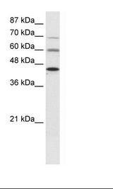 PRMT3 Antibody - HepG2 Cell Lysate.  This image was taken for the unconjugated form of this product. Other forms have not been tested.