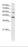 PRMT3 Antibody - HepG2 Cell Lysate.  This image was taken for the unconjugated form of this product. Other forms have not been tested.