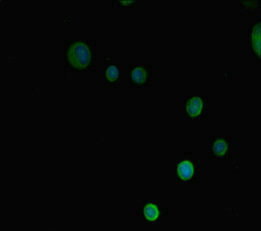 PRMT3 Antibody - Immunofluorescent analysis of MCF7 cells diluted at 1:100 and Alexa Fluor 488-congugated AffiniPure Goat Anti-Rabbit IgG(H+L)