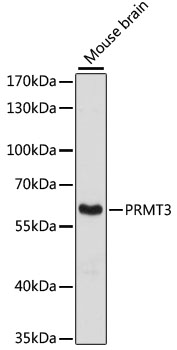 PRMT3 Antibody - Western blot analysis of extracts of mouse brain, using PRMT3 antibody at 1:3000 dilution. The secondary antibody used was an HRP Goat Anti-Rabbit IgG (H+L) at 1:10000 dilution. Lysates were loaded 25ug per lane and 3% nonfat dry milk in TBST was used for blocking. An ECL Kit was used for detection and the exposure time was 90s.