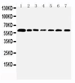 PRMT4 / CARM1 Antibody - WB of PRMT4 / CARM1 antibody. All lanes: Anti-CARM1 at 0.5ug/ml. Lane 1: Rat Spleen Tissue Lysate at 40ug. Lane 2: Human Placenta Tissue Lysate at 40ug. Lane 3: Rat Kidney Tissue Lysate at 40ug. Lane 4: NIH Whole Cell Lysate at 40ug. Lane 5: HELA Whole Cell Lysate at 40ug. Lane 6: HL60 Whole Cell Lysate at 40ug. Lane 7: JURKAT Whole Cell Lysate at 40ug. Predicted bind size: 60KD. Observed bind size: 60KD.