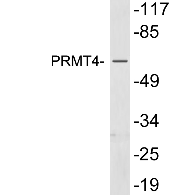 PRMT4 / CARM1 Antibody - Western blot analysis of lysates from Jurkat cells, using PRMT4 antibody.