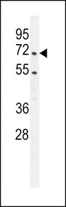 PRMT4 / CARM1 Antibody - PRMT4 Antibody western blot of Jurkat cell line lysates (35 ug/lane). The PRMT4 antibody detected the PRMT4 protein (arrow).