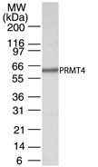 PRMT4 / CARM1 Antibody - Western blot of PRMT4 in cell lysates from HeLa cells using antibody at 0.5 ug /ml. Twenty microgram of HeLa cell lysate was loaded per well of mini gel.