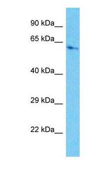 PRMT4 / CARM1 Antibody - Western blot of CARM1 Antibody with HepG2 Whole Cell lysate.  This image was taken for the unconjugated form of this product. Other forms have not been tested.