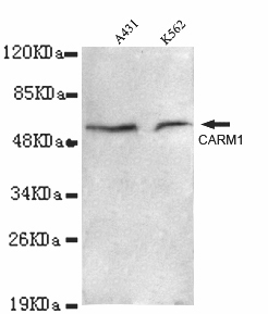 PRMT4 / CARM1 Antibody - CARM1-C antibody at 1/1000 dilution Lane1: A431 whole cell lysate 40 ug/Lane Lane2:K562 whole cell lysate 40 ug/Lane.