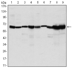 PRMT4 / CARM1 Antibody - Western blot using CARM1 mouse monoclonal antibody against MCF-7 (1), HeLa (2), NIH/3T3 (3), HL-60 (4), LNcap (5), Jurkat (6), PC-3 (7), Cos7 (8), and PC-12 (9) cell lysate.