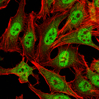 PRMT4 / CARM1 Antibody - Immunofluorescence of HeLa cells using CRAM1 mouse monoclonal antibody (green). Red: Actin filaments have been labeled with Alexa Fluor-555 phalloidin.