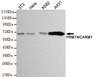 PRMT4 / CARM1 Antibody - Western blot detection of PRMT4/CARM1 in HeLa, A431 and K562 cell lysates using PRMT4/CARM1 mouse monoclonal antibody (1:200-1:500 dilution). Predicted band size: 63KDa. Observed band size:63KDa.
