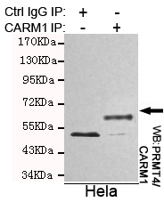 PRMT4 / CARM1 Antibody - Immunoprecipitation analysis of HeLa cell lysates using PRMT4/CARM1 mouse monoclonal antibody.