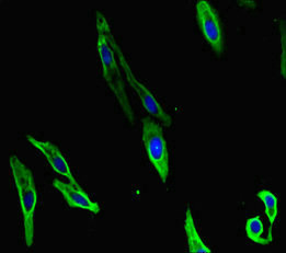 PRMT4 / CARM1 Antibody - Immunofluorescent analysis of Hela cells diluted at 1:100 and Alexa Fluor 488-congugated AffiniPure Goat Anti-Rabbit IgG(H+L)
