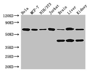 PRMT4 / CARM1 Antibody - Western Blot Positive WB detected in:Hela whole cell lysate,MCF-7 whole cell lysate,NIH/3T3 whole cell lysate,Jurkat whole cell lysate,Mouse brain tissue,Mouse liver tissue,Mouse kidney tissue All Lanes: CARM1 antibody at 3.4ug/ml Secondary Goat polyclonal to rabbit IgG at 1/50000 dilution Predicted band size: 66,64,42 kDa Observed band size: 66,42 kDa