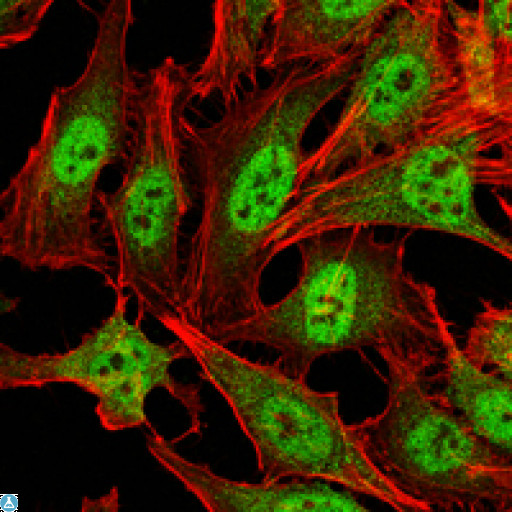 PRMT4 / CARM1 Antibody - Immunofluorescence (IF) analysis of HeLa cells using PRMT4 Monoclonal Antibody (green). Red: Actin filaments have been labeled with Alexa Fluor-555 phalloidin.