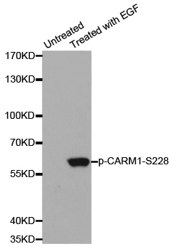 PRMT4 / CARM1 Antibody - Western blot analysis of extracts from A431 cells.