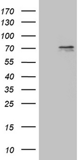 PRMT5 Antibody - HEK293T cells were transfected with the pCMV6-ENTRY control. (Left lane) or pCMV6-ENTRY PRMT5. (Right lane) cDNA for 48 hrs and lysed