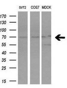 PRMT5 Antibody - Western blot analysis of extracts. (10ug) from 3 different cell lines by using anti-PRMT5 monoclonal antibody. (1:200)