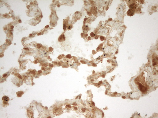 PRMT5 Antibody - Immunohistochemical staining of paraffin-embedded Human lung tissue within the normal limits using anti-PRMT5 mouse monoclonal antibody. (Heat-induced epitope retrieval by 1 mM EDTA in 10mM Tris, pH8.5, 120C for 3min,