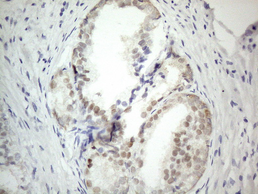 PRMT5 Antibody - Immunohistochemical staining of paraffin-embedded Human prostate tissue within the normal limits using anti-PRMT5 mouse monoclonal antibody. (Heat-induced epitope retrieval by 1mM EDTA in 10mM Tris buffer. (pH8.5) at 120°C for 3 min. (1:150)