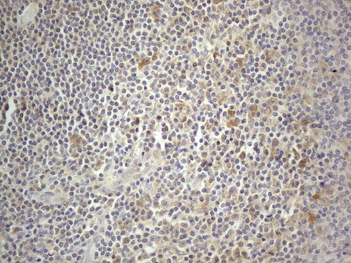PRMT5 Antibody - Immunohistochemical staining of paraffin-embedded Human tonsil within the normal limits using anti-PRMT5 mouse monoclonal antibody. (Heat-induced epitope retrieval by 1mM EDTA in 10mM Tris buffer. (pH8.5) at 120°C for 3 min. (1:150)