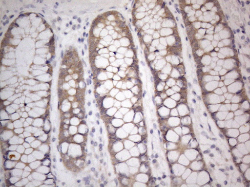 PRMT5 Antibody - Immunohistochemical staining of paraffin-embedded Human colon tissue within the normal limits using anti-PRMT5 mouse monoclonal antibody. (Heat-induced epitope retrieval by 1mM EDTA in 10mM Tris buffer. (pH8.5) at 120°C for 3 min. (1:150)