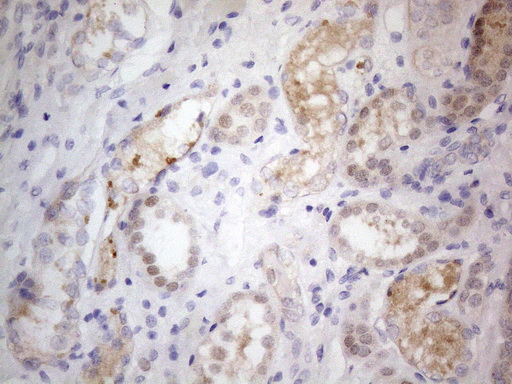 PRMT5 Antibody - Immunohistochemical staining of paraffin-embedded Human Kidney tissue within the normal limits using anti-PRMT5 mouse monoclonal antibody. (Heat-induced epitope retrieval by 1mM EDTA in 10mM Tris buffer. (pH8.5) at 120°C for 3 min. (1:150)