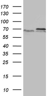 PRMT5 Antibody - HEK293T cells were transfected with the pCMV6-ENTRY control. (Left lane) or pCMV6-ENTRY PRMT5. (Right lane) cDNA for 48 hrs and lysed. Equivalent amounts of cell lysates. (5 ug per lane) were separated by SDS-PAGE and immunoblotted with anti-PRMT5. (1:500)