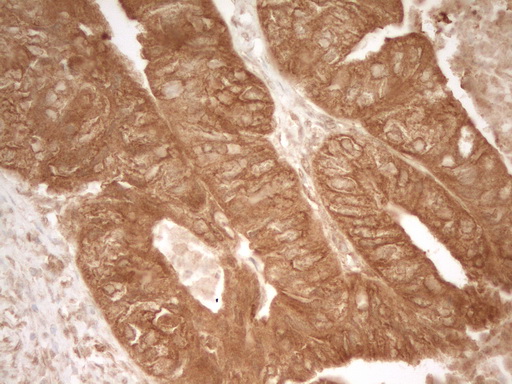 PRMT5 Antibody - Immunohistochemical staining of paraffin-embedded Human pancreas tissue within the normal limits using anti-PRMT5 mouse monoclonal antibody. (Heat-induced epitope retrieval by 1 mM EDTA in 10mM Tris, pH8.5, 120C for 3min,