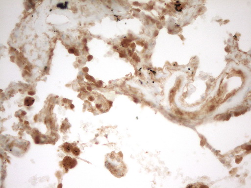 PRMT5 Antibody - Immunohistochemical staining of paraffin-embedded Human lung tissue within the normal limits using anti-PRMT5 mouse monoclonal antibody. (Heat-induced epitope retrieval by 1 mM EDTA in 10mM Tris, pH8.5, 120C for 3min,