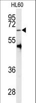 PRMT5 Antibody - Western blot of anti-PRMT5 Antibody (C-term C487) in HL60 cell line lysates (35 ug/lane). PRMT5(arrow) was detected using the purified antibody.