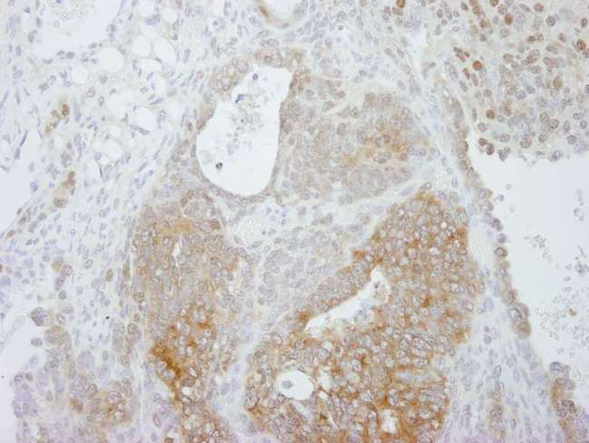PRMT5 Antibody - Detection of Mouse PRMT5 by Immunohistochemistry. Sample: FFPE section of mouse teratoma. Antibody: Affinity purified rabbit anti-PRMT5 used at a dilution of 1:250.