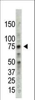 PRMT5 Antibody - The anti-PRMT5 antibody is used in Western blot to detect PRMT5 in HL60 cell lysate.