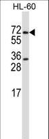 PRMT5 Antibody - PRMT5 Antibody western blot of HL-60 cell line lysates (35 ug/lane). The PRMT5 antibody detected the PRMT5 protein (arrow).