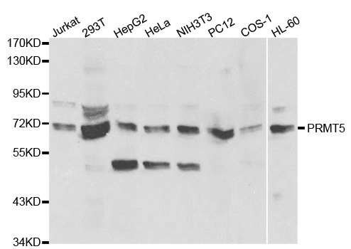 PRMT5 Antibody - Western blot analysis of extracts of various cell lines, using PRMT5 antibody.