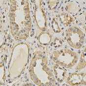 PRMT5 Antibody - Immunohistochemistry of paraffin-embedded human stomach using COL5A1 antibody at dilution of 1:200 (x400 lens)